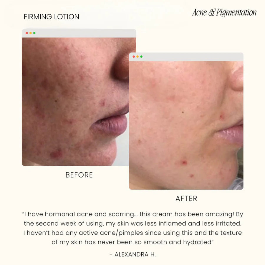 Firming Lotion