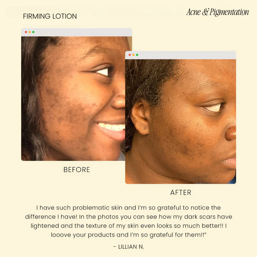 Firming Lotion